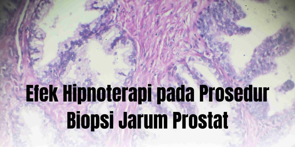 Efek Hipnoterapi pada Prosedur Biopsi Jarum Prostat